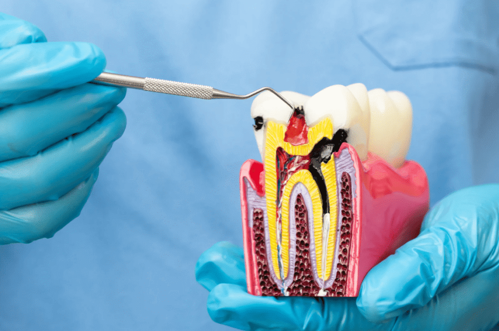 杜牙根收費與影響價錢的因素 The cost of root canal treatment and factors affecting the price