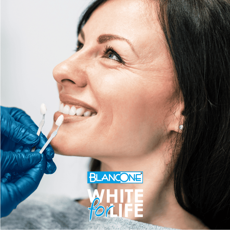 BlancOne Whitening 美白牙齒方案